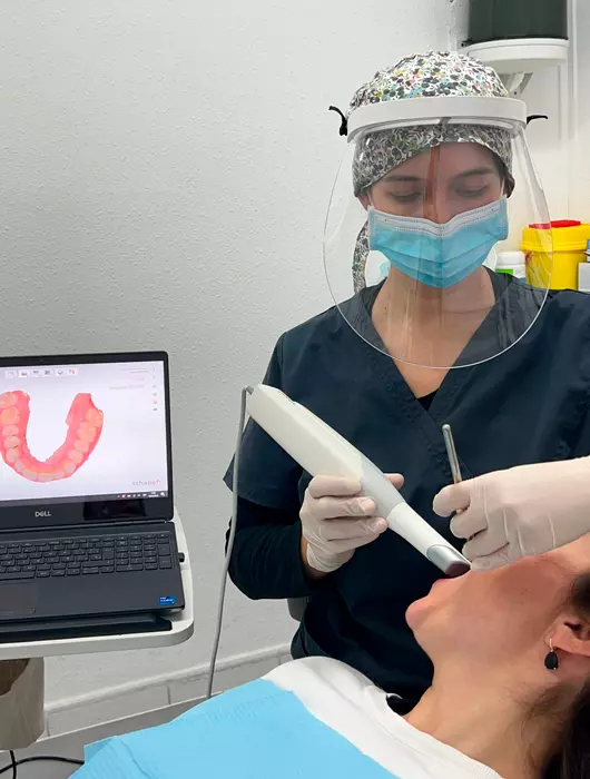 Foto Escaner intraoral Clinica dental en Barcelona